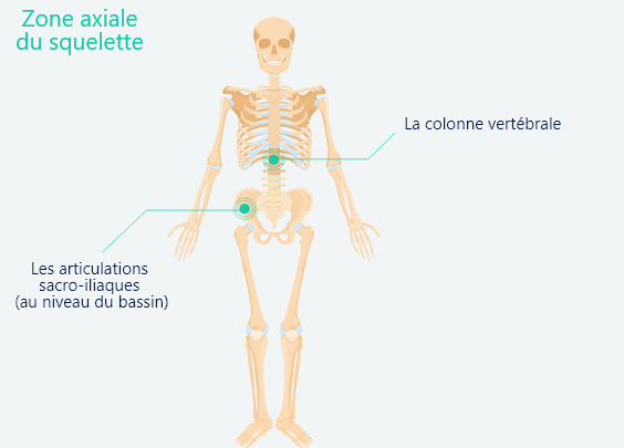 spondyloarthrite axiale